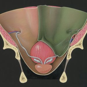Urologie