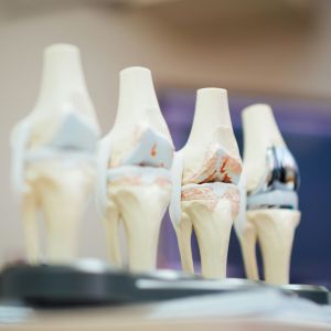 Ortopedie – Traumatologie